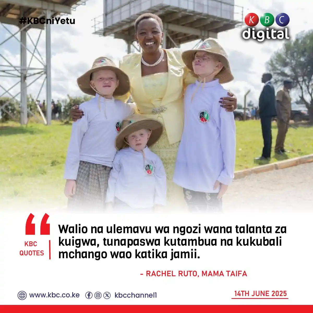 Image from KBC Digital: Walio na ulemavu wa ngozi wana talanta za kuigwa, tunapaswa kutambua n...