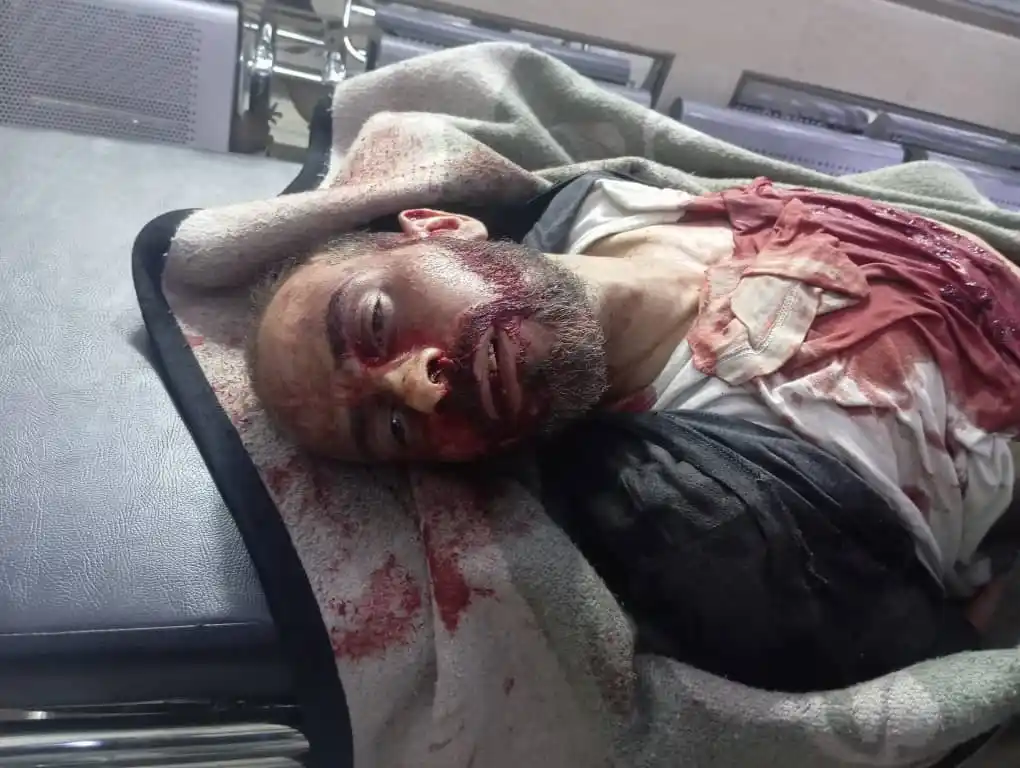 Image from الشبكة السورية الحرة: لله الحمد قبل قليل و أثناء ممارسته رياضة المشي في حي صلاح الدين في مدي...