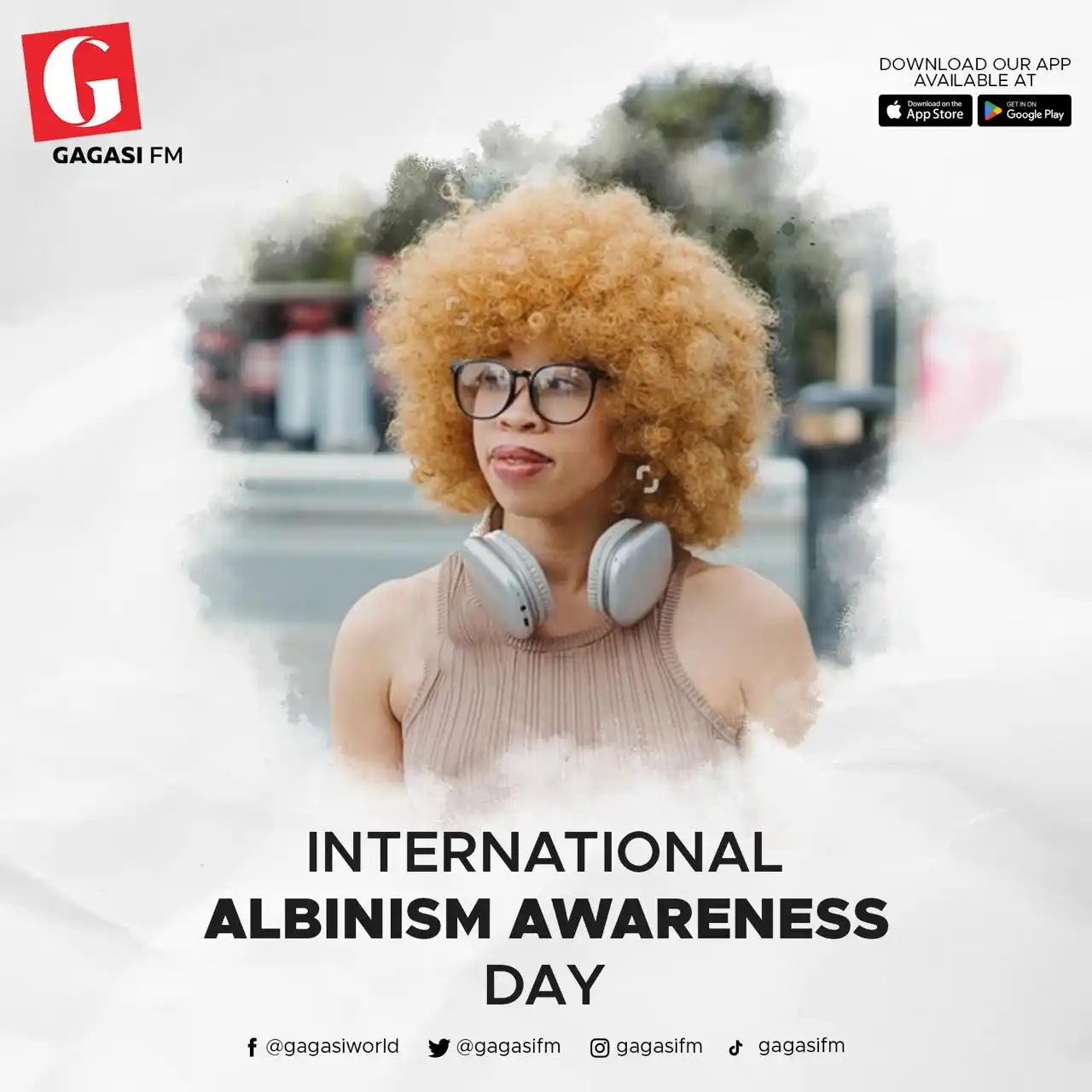 Image from Gagasi FM: Today, we stand in solidarity with people living with albinism. We sup...