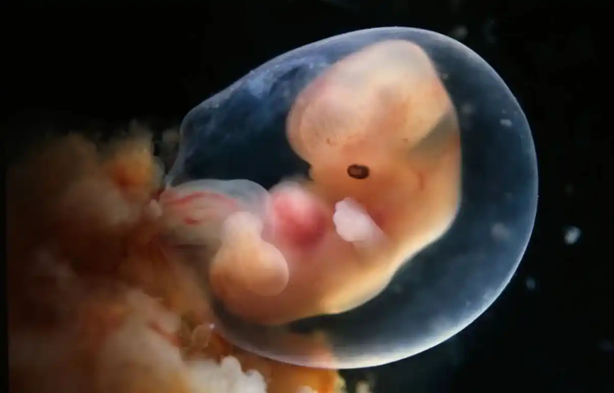 Omni Letters - Brasil post