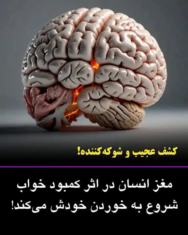 Image from Doctor Ekhlas 👸🏻🥼🫀: بر اساس یک مطالعهی پیشگامانه که در مجله علوم اعصاب منتشر شده است، مغز...