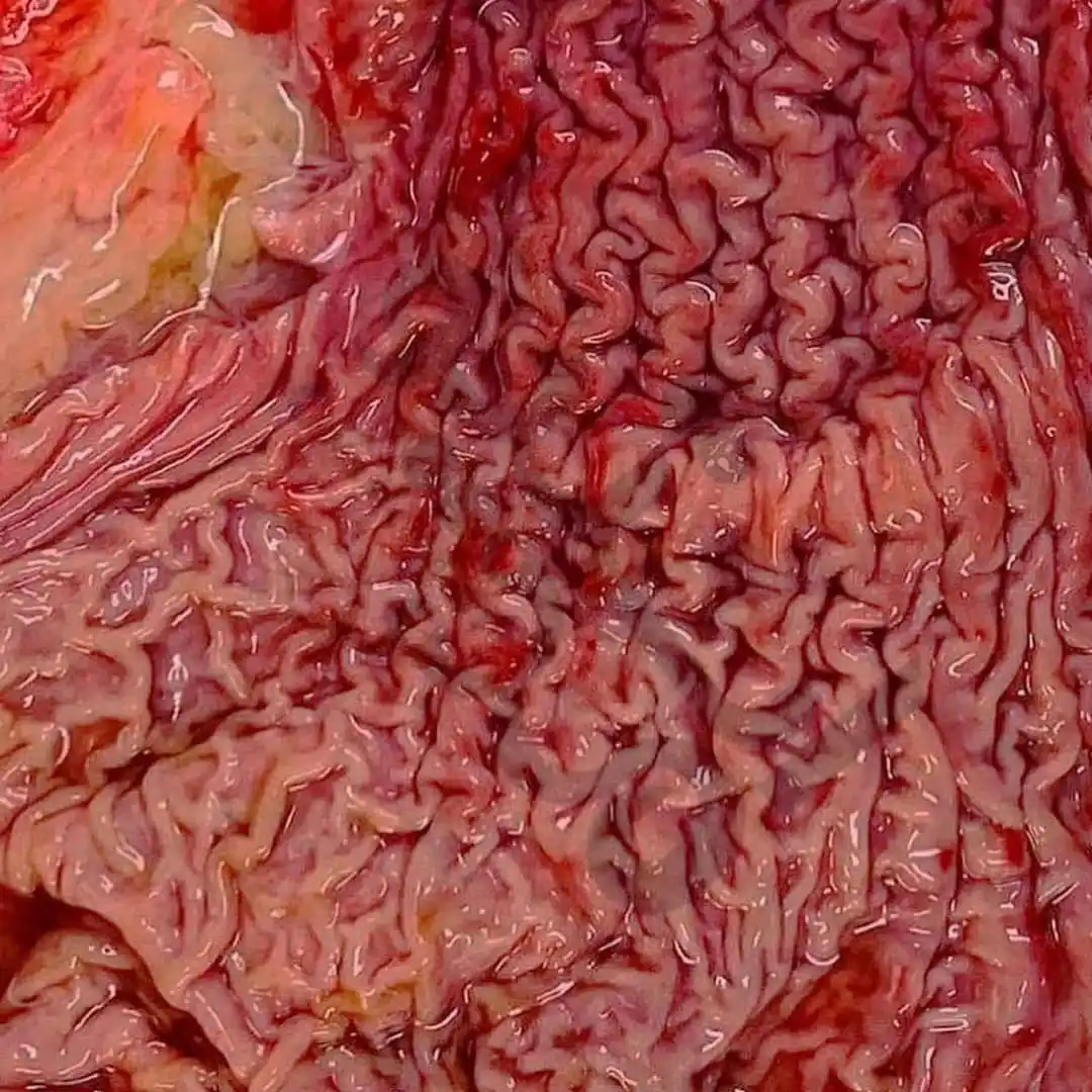 Image from Doctor Ekhlas 👸🏻🥼🫀: چین خوردگی مخاط معده⭐...