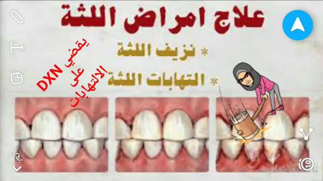 Image from DXN للجميع دول العالم : ماهو معجون جانوزي 😍 هو معجون أسنان صحي مبتكر من خلاصة الجانوديرما عا...