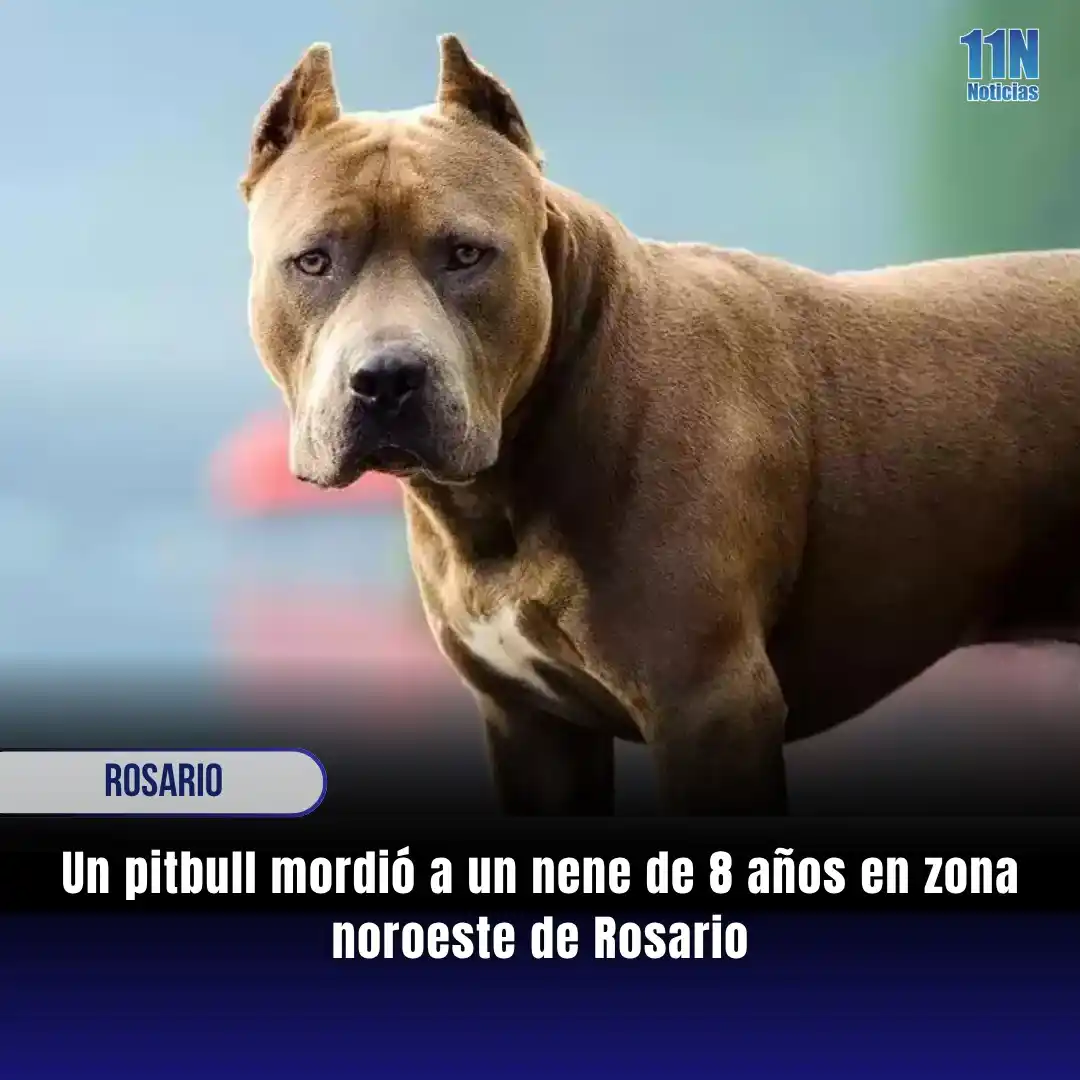 Image from 11Noticias: *🐕‼️ Un pitbull mordió a un nene de 8 años en zona noroeste de Rosari...