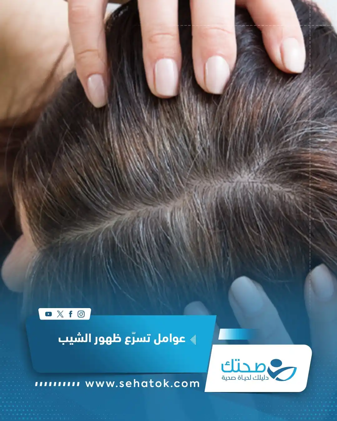 Image from موقع صحتك: عادة ما يظهر الشيب أولا في منطقتي الصدغين ثم ينتشر إلى مؤخرة الرأس. وي...