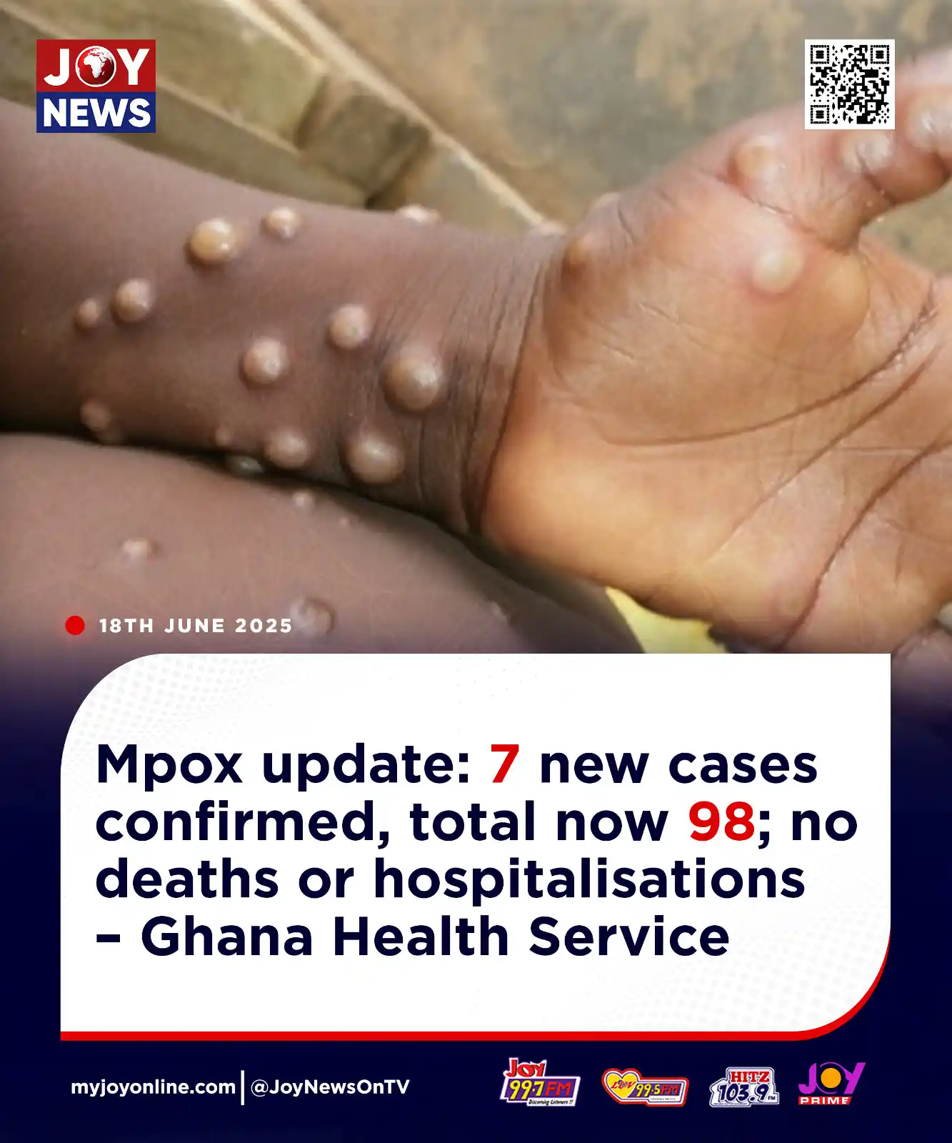 Image from Myjoyonline: Mpox update: 7 new cases confirmed, total now 98; no deaths or hospita...
