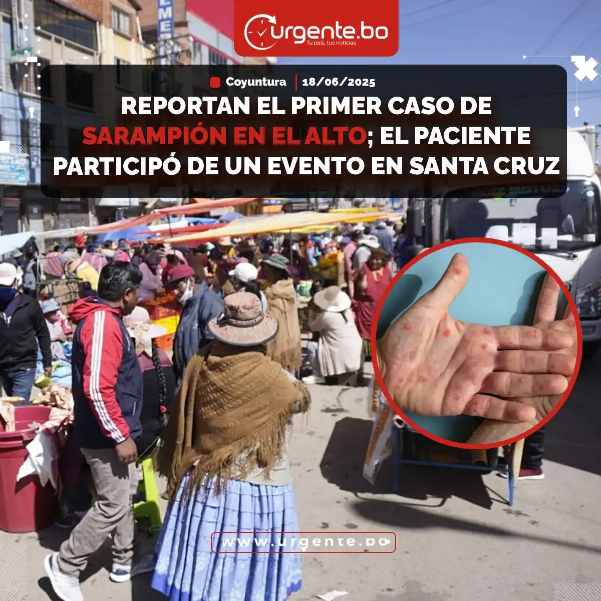 Image from Urgente.bo Noticias: Urgente.bo | *๐ฆ๐ฒ ๐๐ฟ๐ฎ๐๐ฎ ๐ฑ๐ฒ ๐๐ป ๐ฎ๐ฑ๐ผ๐น๐ฒ๐๐ฐ๐ฒ๐ป๐๐ฒ, ๐ฑ๐ฒ ๏ฟฝ...