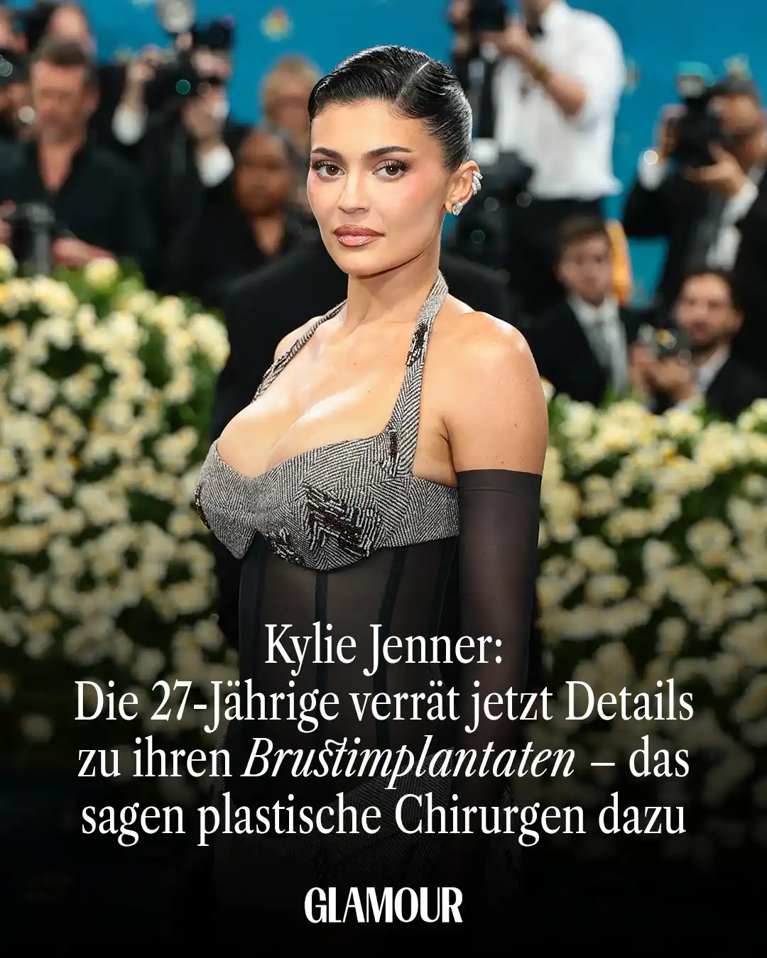 Image from GLAMOUR Germany: Über kosmetische Eingriffe offen zu sprechen, ist bei vielen Celebs im...