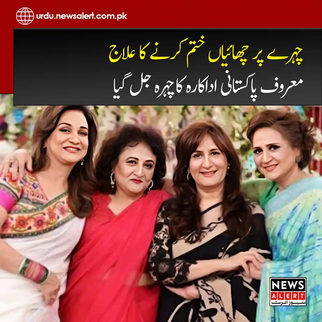 Image from News Alert: https://urdu.newsalert.com.pk/infotainment/asma-abbas-suffers-skin-all...