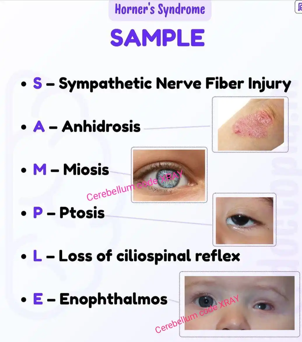 Image from NEET PG/INCET/FMGE PREPARATION⚕️🏥👨⚕️👩⚕️🚀: 🎯 *Must Know PYQ NEET 2025* 🎯 *Flashcards* # *NEETPG* *<a class="tex...