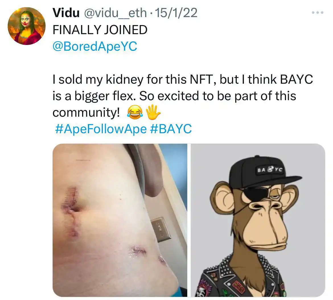Image from Team Justus Safezone International: 🤦♂️ Three years ago, someone sold a kidney to buy a Bored Ape NFT. T...