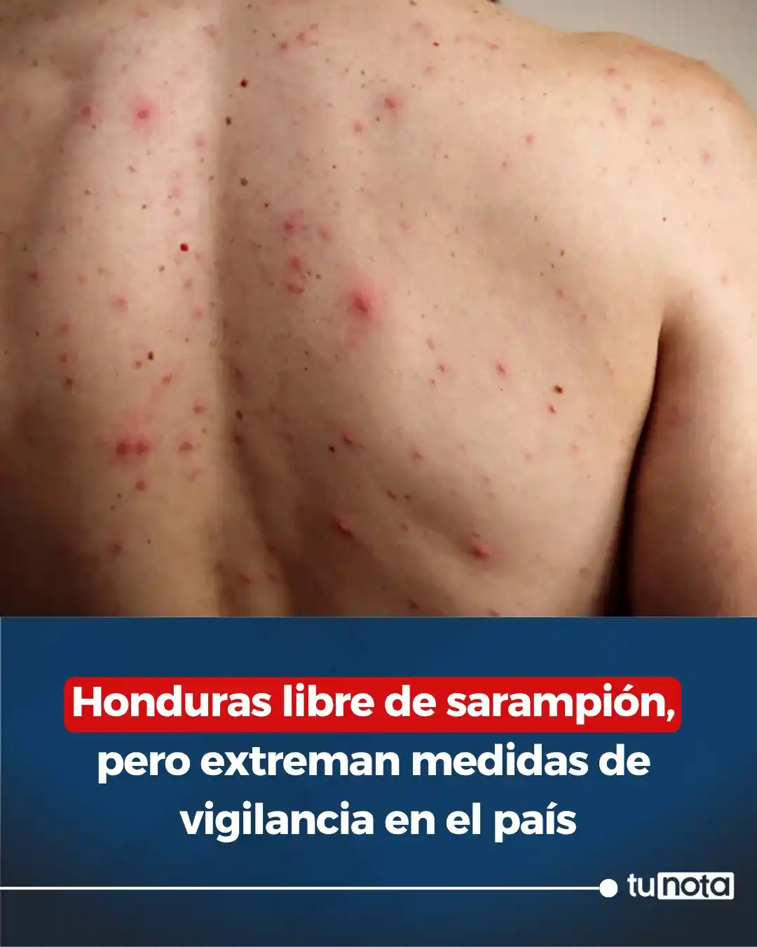 Image from tunota: 🔴A todo viajero que ingrese al país le pedirán el carnet de vacunas. ...