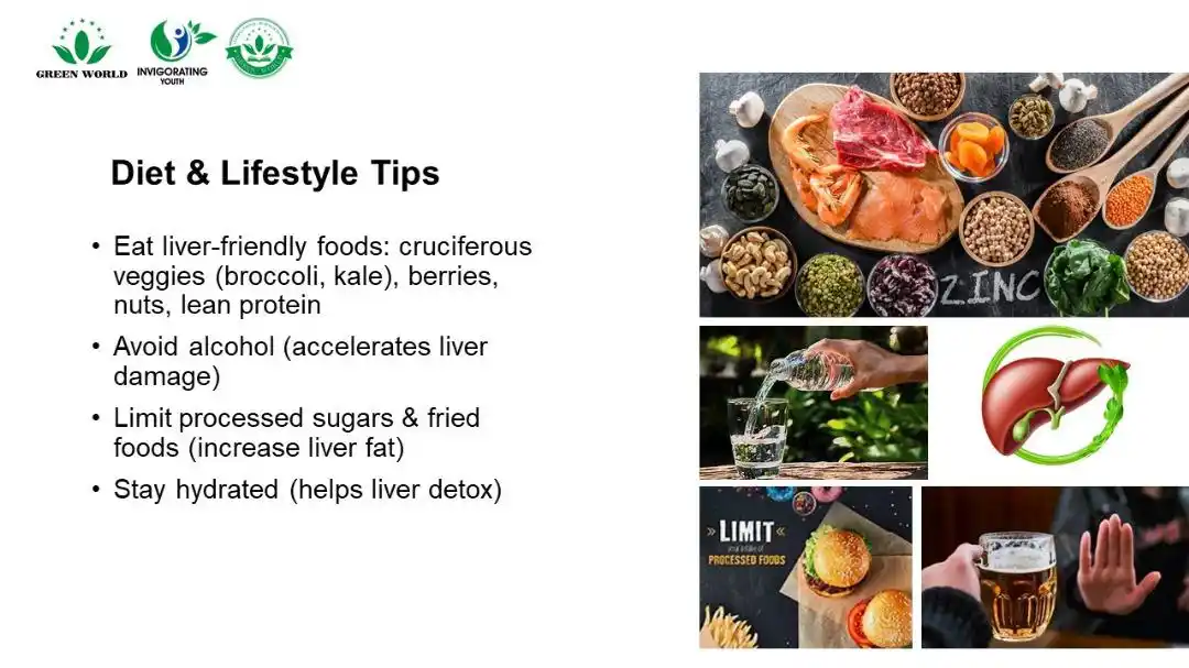 Image from Green World Online Store : Diet & Lifestyle tips : # Eat liver-friendly foods: cruciferous veggi...