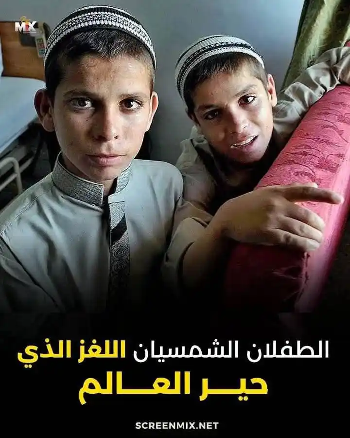 Image from قناة أحلى الكلام🎋🅰🎵🅰🌴: الطفلان الشمسيان .. اللغز الذي حير أطباء العالم ! طفلان من باكستان ار...