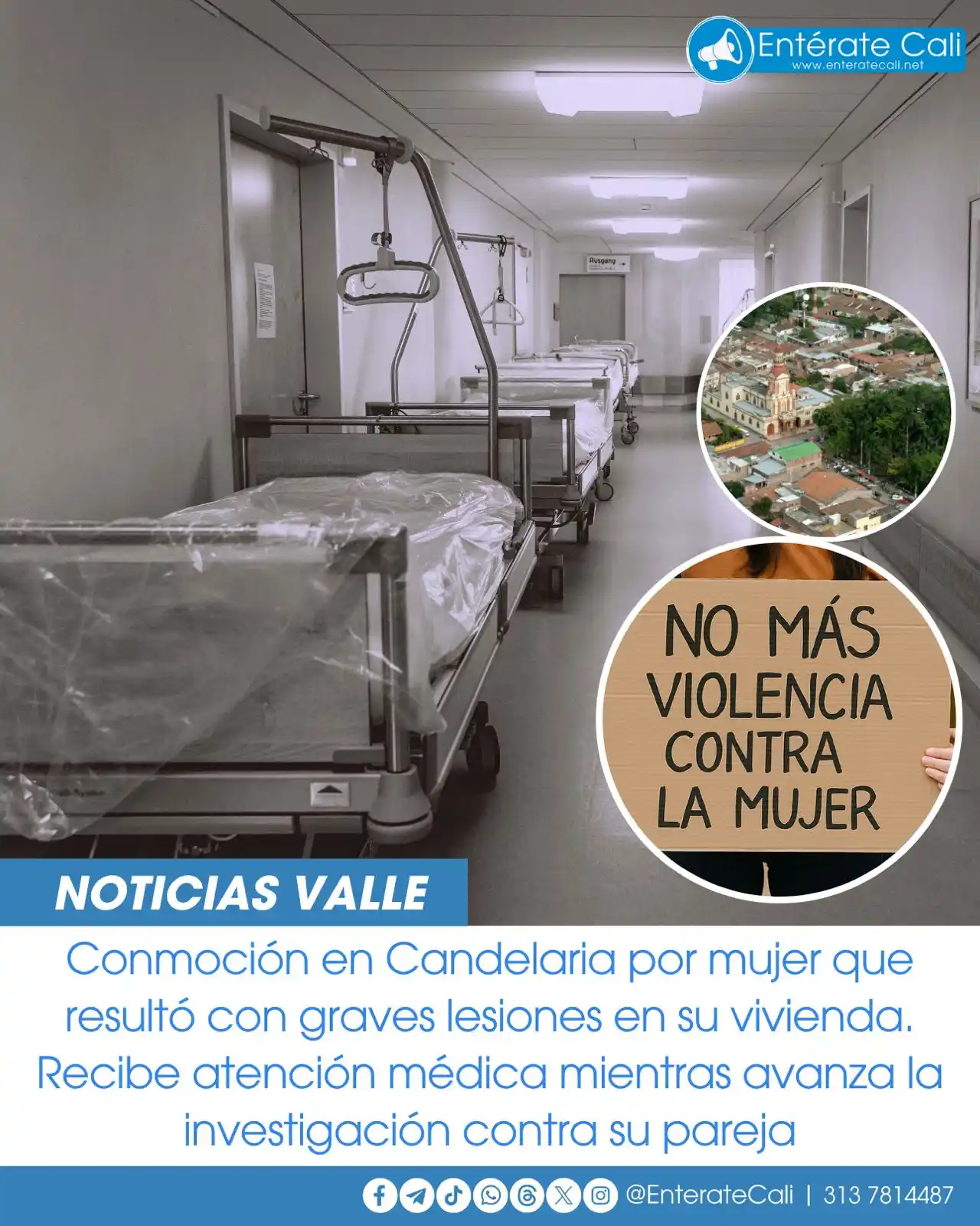 Image from Entérate Cali: Una mujer de aproximadamente 30 años sufrió lesiones en la piel tras u...