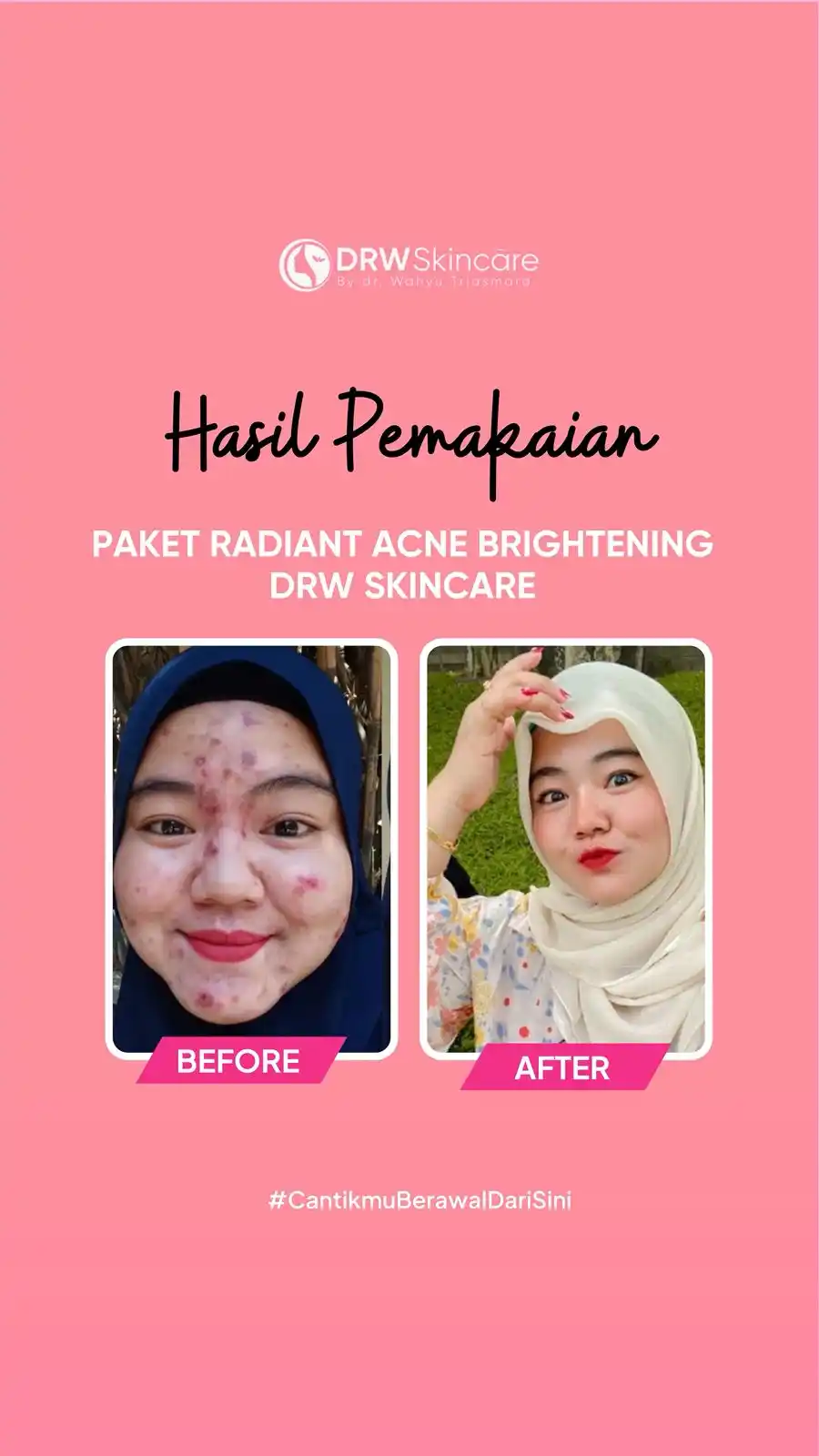 Image from DRW Skincare: Beauty Consultant diwajibkan komen testimoni hasil pemakaian paket RAB...