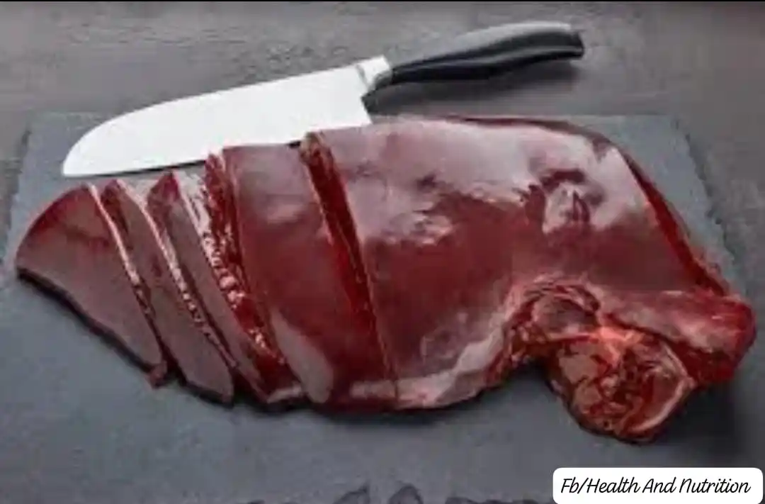 Image from Health And Nutrition: Hairloss?   Low thyroid hormones?  Eat more BEEF LIVER.  It is an abun...