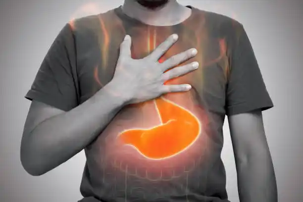 Image from Health And Nutrition: It’s surprising how many people suffer from acid reflux or GERD. Neith...