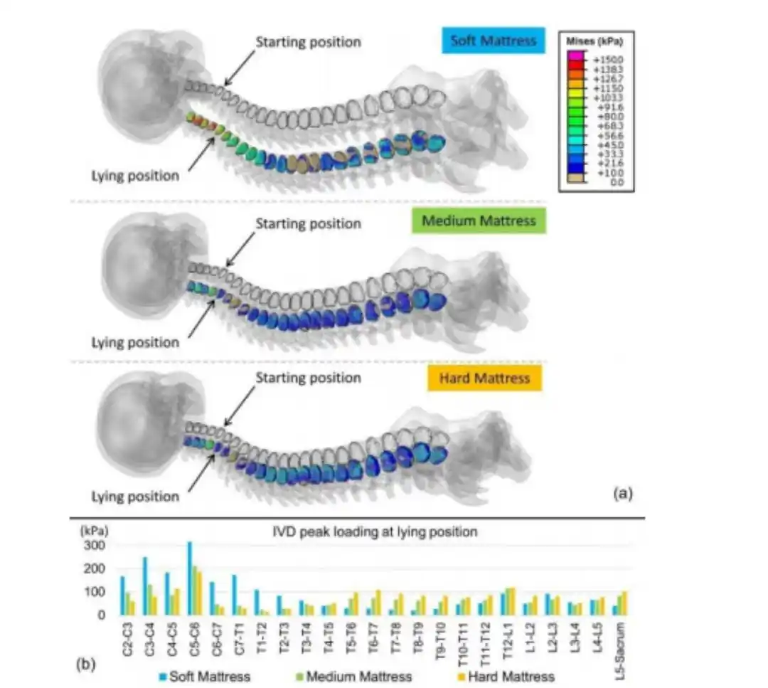 Image from Health And Nutrition: Sleep and the spine :   Older studies mentioned that tribes often woul...