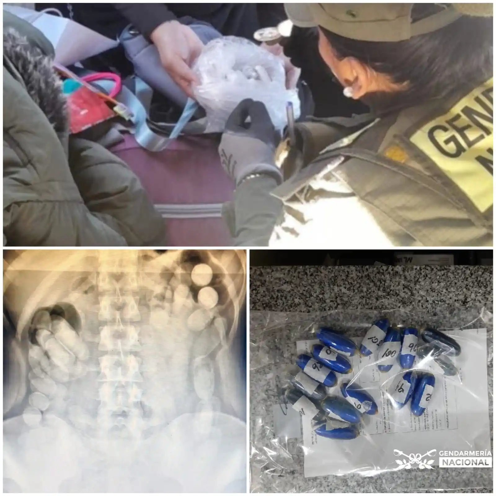 Image from Gendarmería Nacional Argentina: ⭕Tucumán: *Gendarmes descubrieron que una mujer tenía cápsulas en su b...