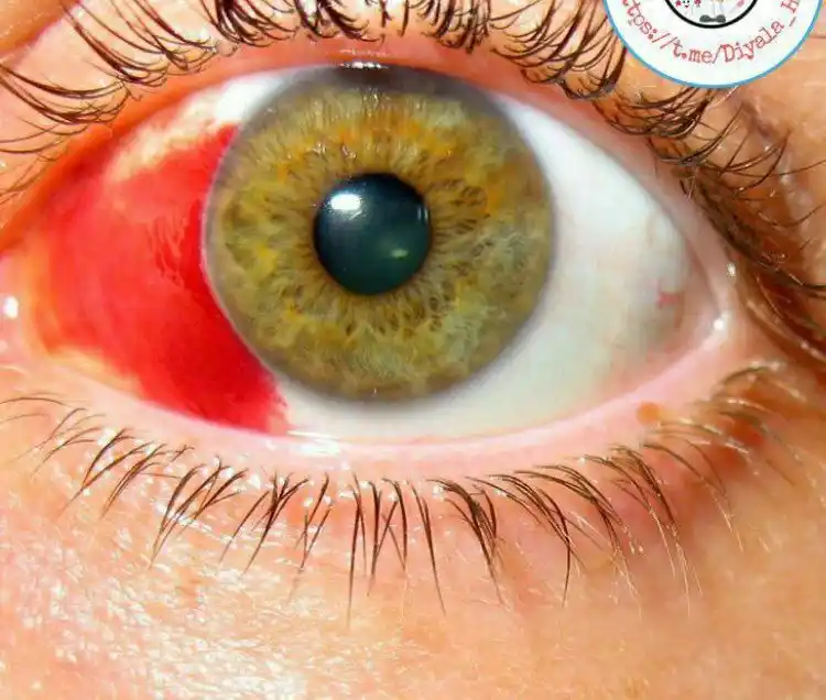 Image from عــآلــم آلـمــعـــ📖ــرفـهہ❤‍🔥📌: <a class="text-blue-500 hover:underline cursor-pointer" href="/hashtag...