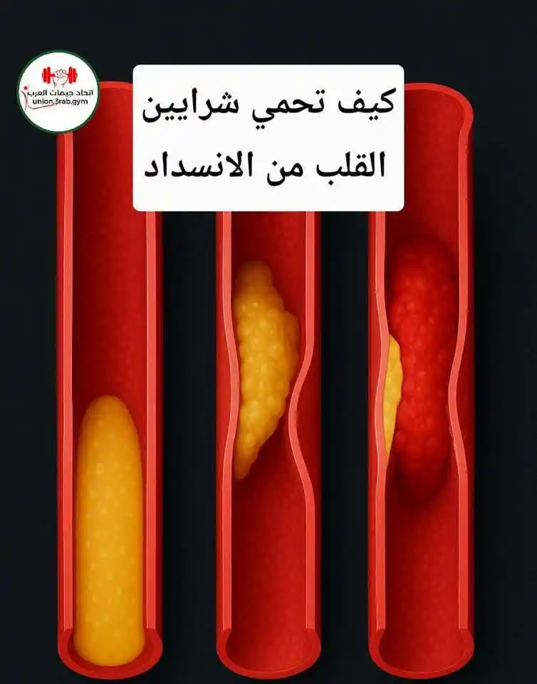 Image from قناة البدر مخصصة للاهتمام بالصحة والرياضة،: كيف تتجنب أن الشرايين ماتنسدش؟ 🙂 مش لازم توصل لجلطة عشان تهتم .. كفا...