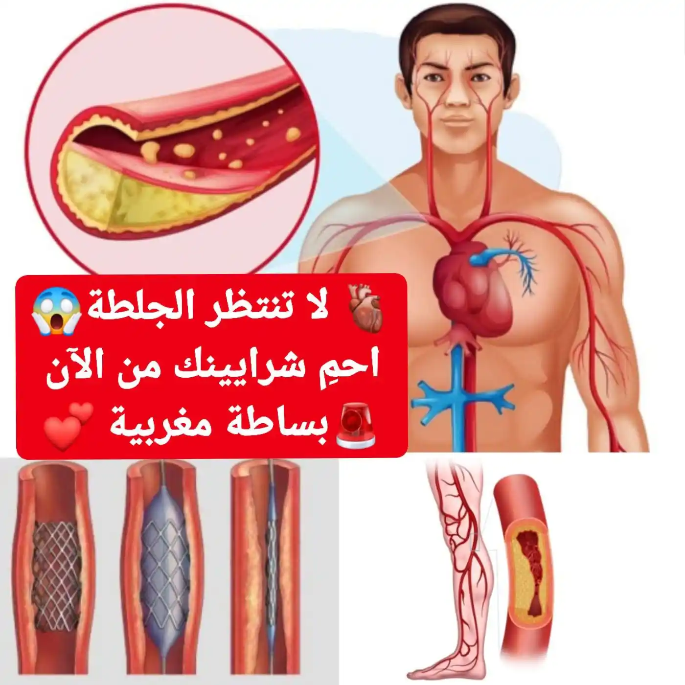 Image from قناة البدر مخصصة للاهتمام بالصحة والرياضة،: 🫀 لا تنتظر الجلطة... احمِ شرايينك من الآن! كثيرون لا يلتفتون إلى صحة...
