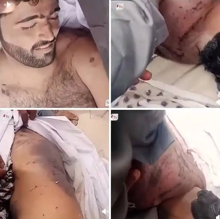 Image from د غورځنګ میډیا✌️PTM Updates): پاکستانی فورسز کی تحویل میں بلوچ نوجوان پر جیل میں انتہائی سحت تشدد ہو...