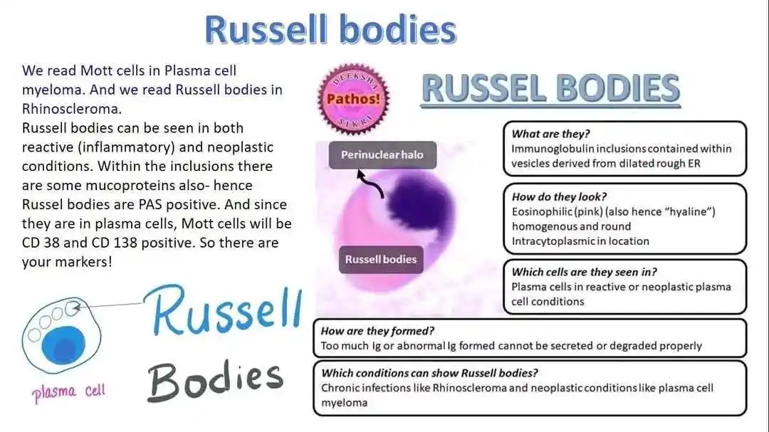 Image from 🔬Forum of Clinical Laboratories💉: _*Examples of conditions:*_ - Russell bodies can be found in condition...