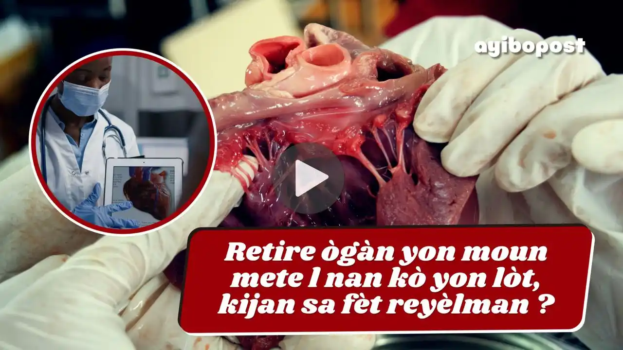 Image from AyiboPost: 🤔 Kisa ki dwe fèt pou yo retire ògàn yon moun pou mete l nan kò yon l...