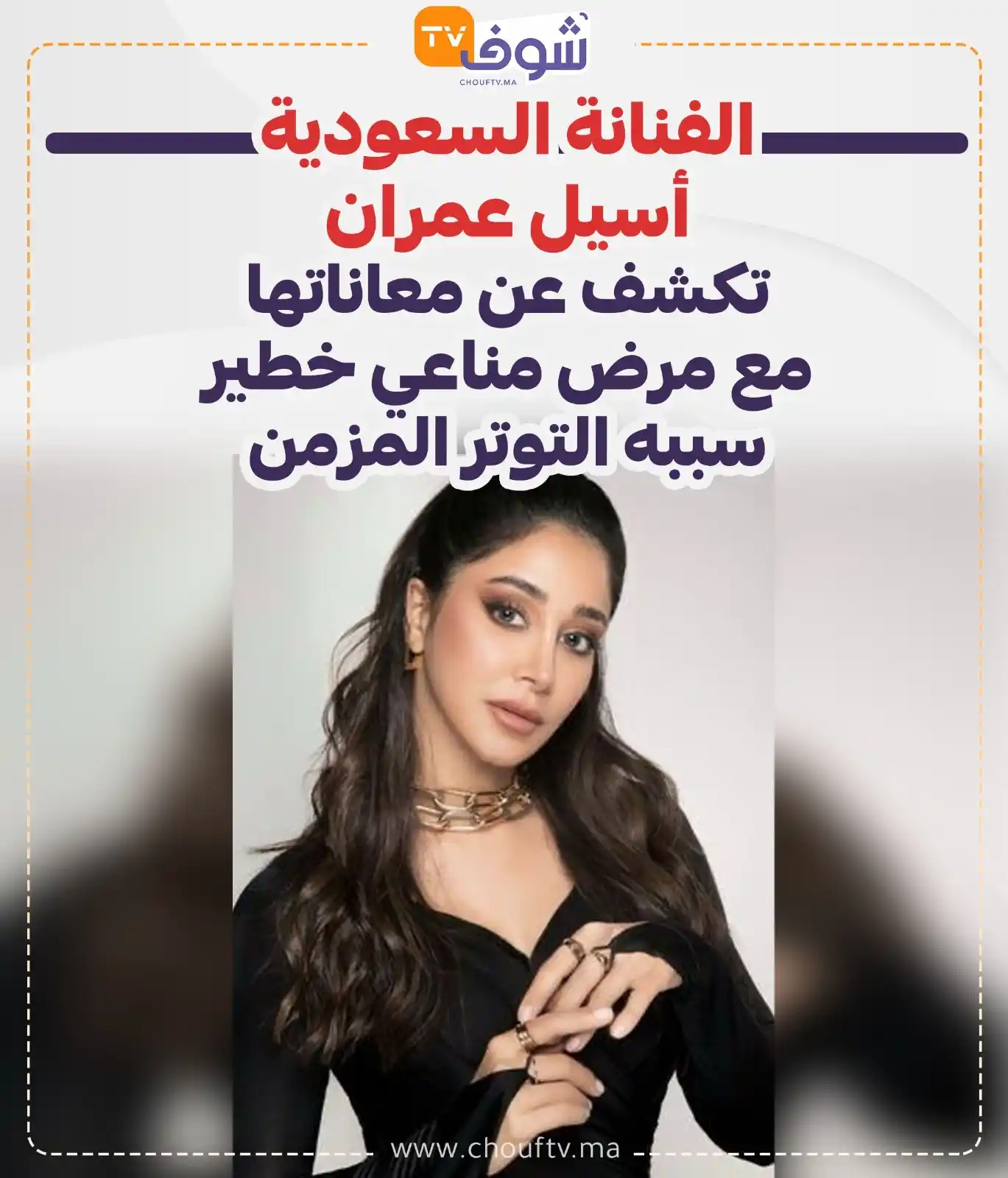 Image from ChoufTV: الفنانة السعودية أسيل عمران تكشف عن معاناتها مع مرض مناعي خطير سببه ال...