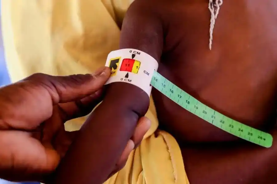 Image from SenCaféActu : La lutte contre la malnutrition demeure un défi majeur pour l’État sén...