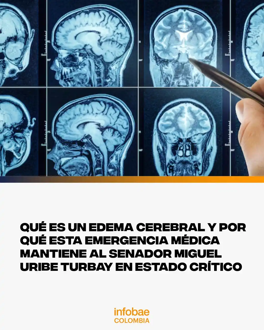Image from Infobae Colombia: 🧠 <a class="text-blue-500 hover:underline cursor-pointer" href="/hash...