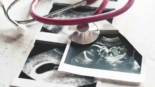 Image from Vatican News PL: *Brazylia: trwa parlamentarna debata nt. legalizacji aborcji* Społec...