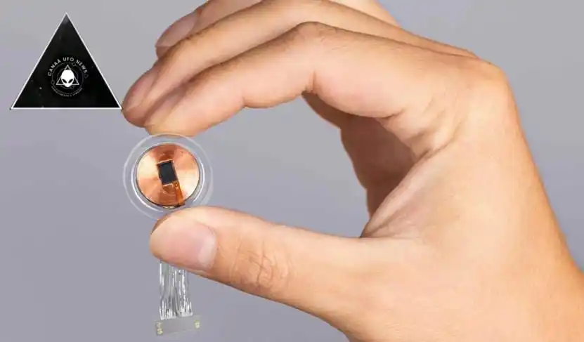 Image from CANAÃ UFO NEWS/INVESTIGATION SCiENTiFiC: *O dispositivo da Neuralink faz você ver coisas que não são reais* Ca...