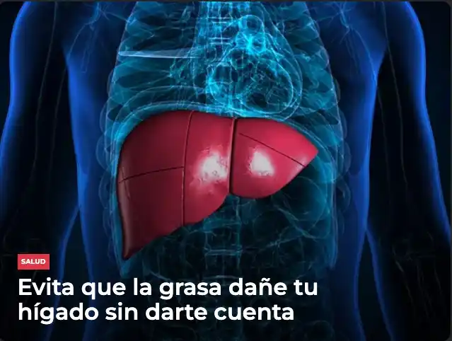 Image from Meganoticias: 👩‍⚕️🇲🇽👨‍⚕️ El IMSS advierte sobre la acumulación excesiva de grasa...