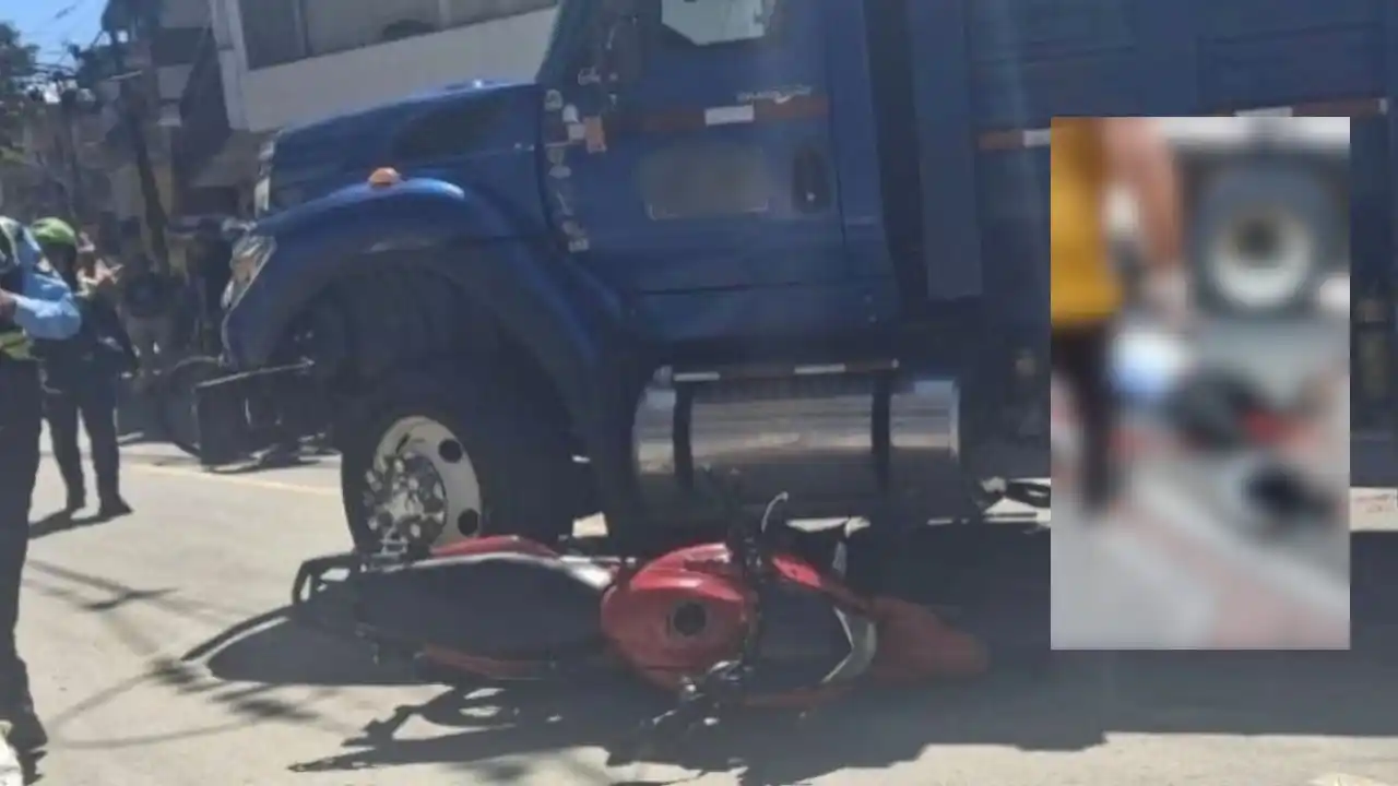 Image from Hora 13 Noticias: *¡Dios mio! Motociclista quedó con grave lesión en pierna tras acciden...