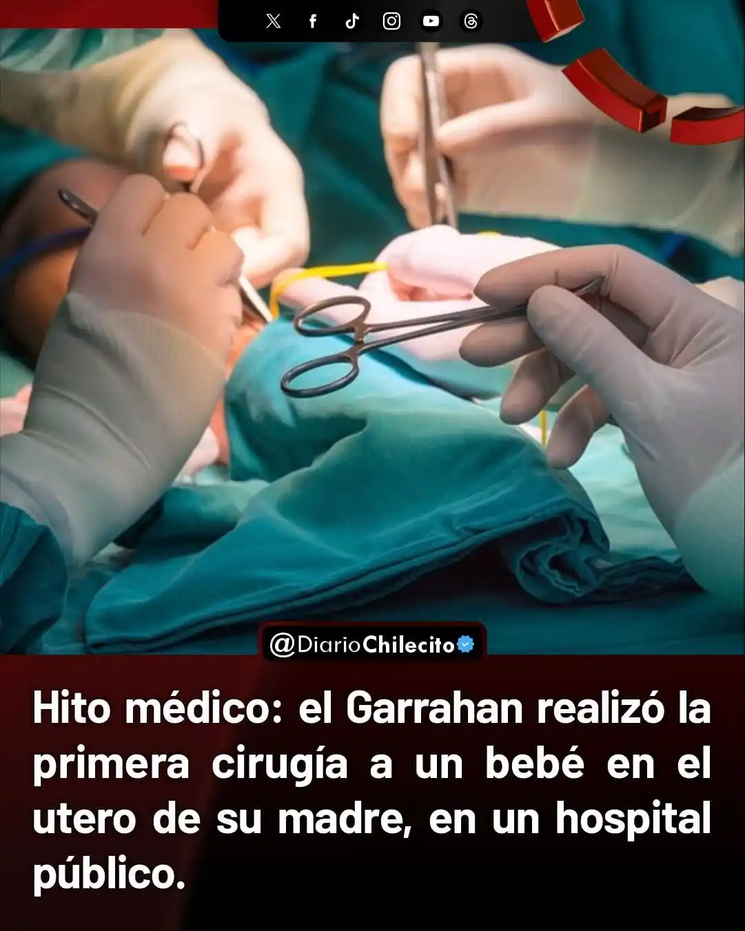 Image from Diario Chilecito: ● El Hospital Garrahan realizó la primera cirugía fetal intrauterina e...