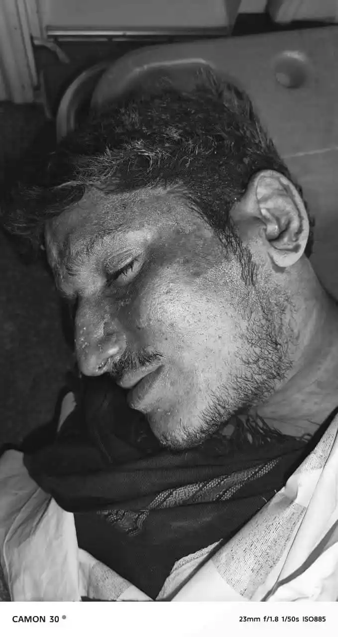 Image from MG News: مردان۔۔۔غلہ ڈھیر صحبت کلے قریب کلپانی میں لاوارث لاش برآمد۔۔۔ریسکیو112...