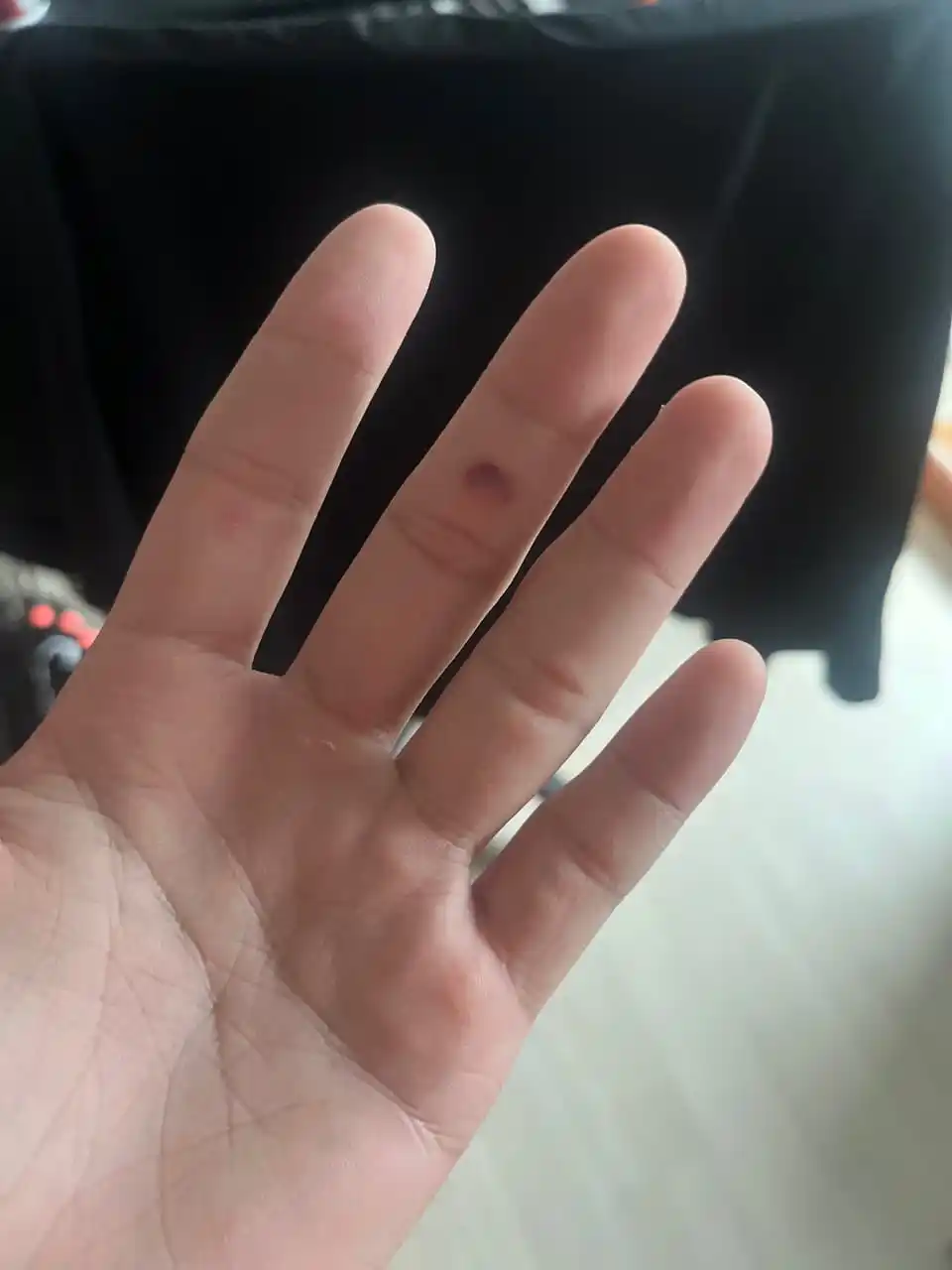 Image from Gaon & Xdinary Heroes Daily Update ✨: Gunil bbl 💌 1.29PM  It’s been a while since I had a proper blister ㅋㅋ...