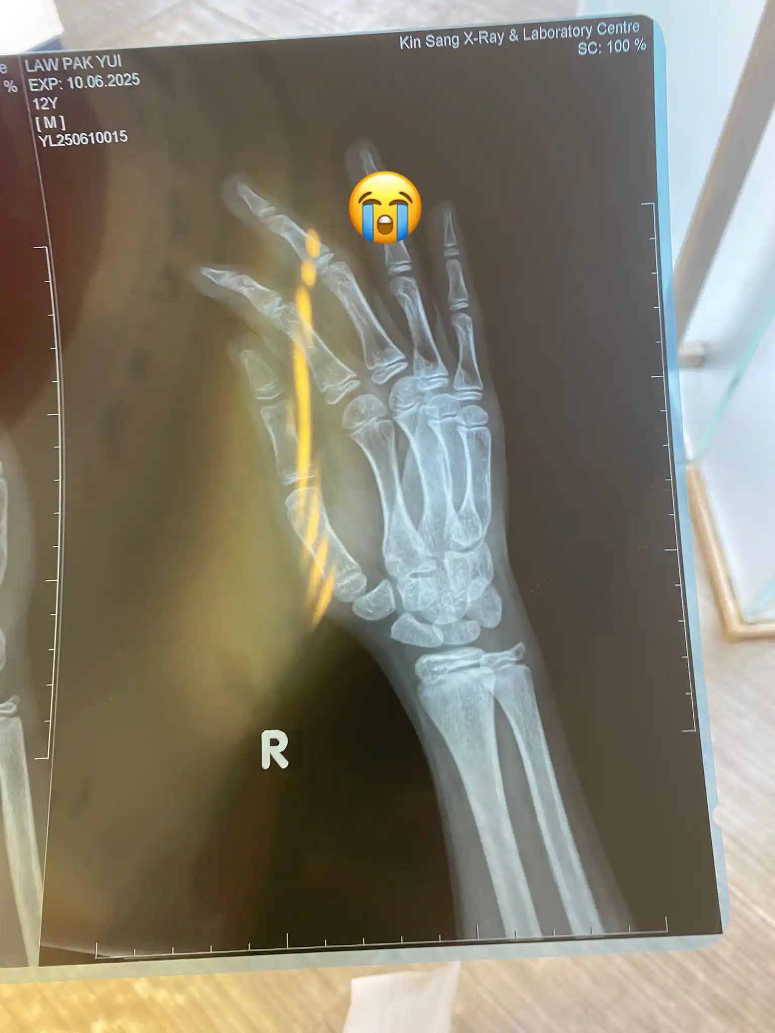 蘿蔔糕’s channel  post