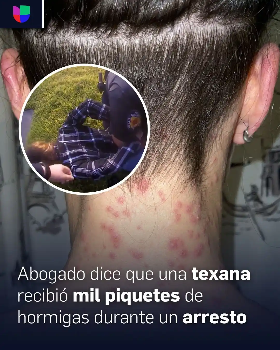 Image from Univision 45 Houston: Ella recibió al menos 1,000 piquetes de hormigas, *luego de ser forzad...